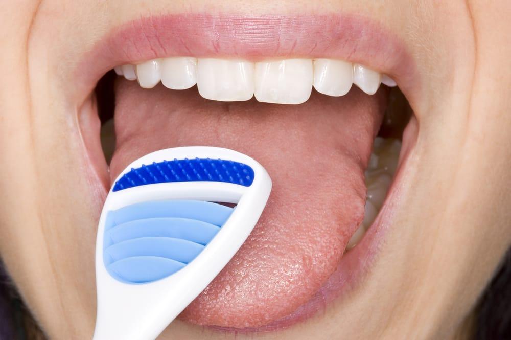 tooth decay 4