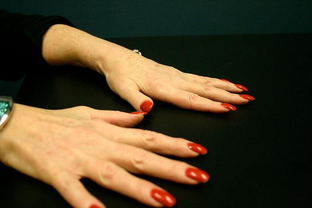 arthritis- Home remedies