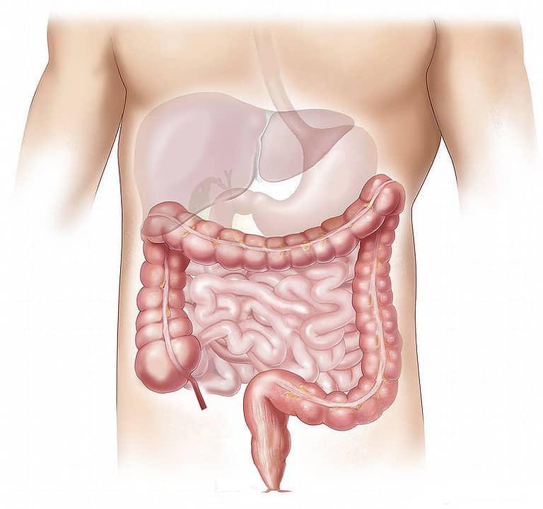food for healthy gut