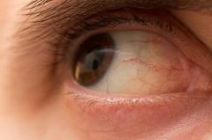 red eyes